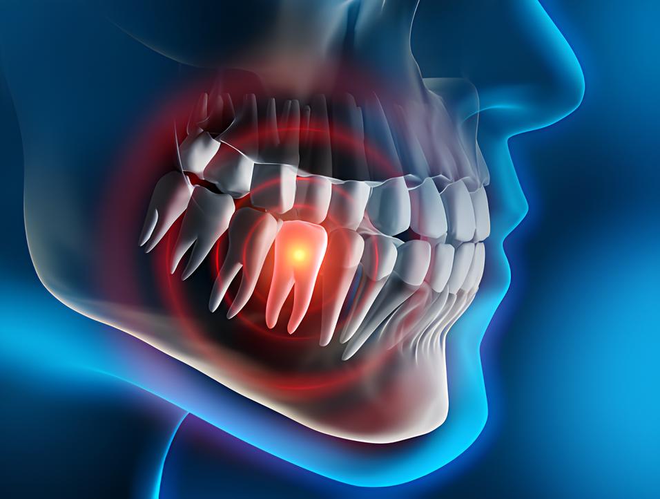 Teeth image - Emergency dentist Grimsby
